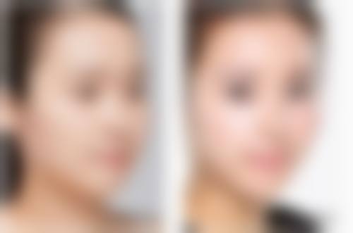 六、松原铭医整形美容医院价格表