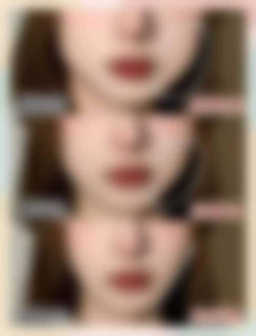 八、襄阳熙蒙医疗美容诊所真实的患者评价