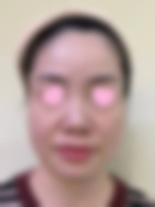 三、襄阳熙蒙医疗美容诊所诊疗项目有哪些？