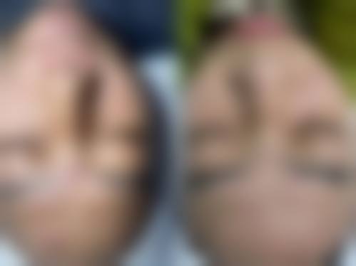 九、松原铭医整形美容医院真实的患者评价