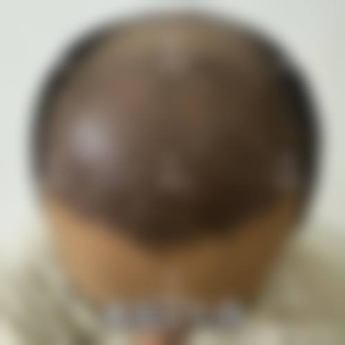 五、北京熙朵植发门诊部医生介绍