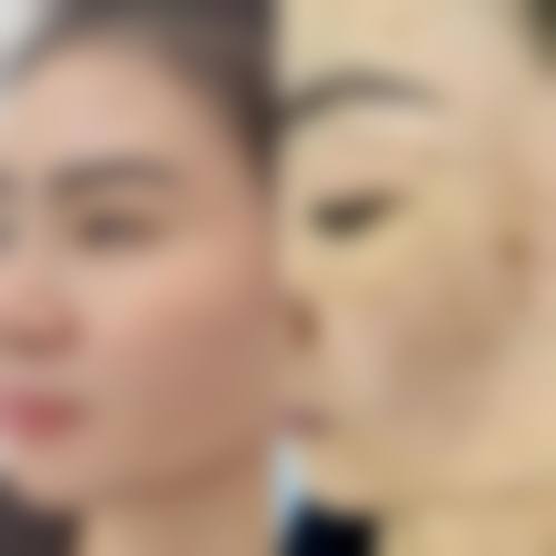 五、郑州大桥医院医疗美容科价格表