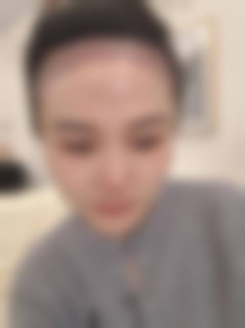 二、北京熙朵植发门诊部怎么样？