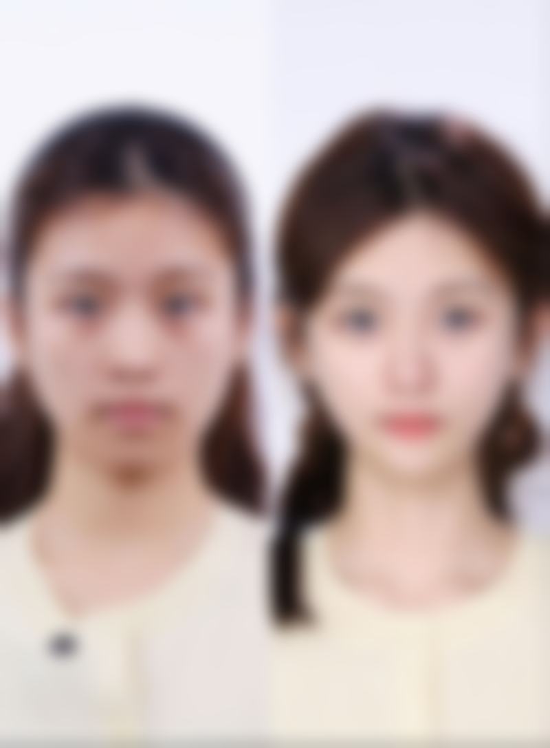 二、襄阳熙蒙医疗美容诊所怎么样？