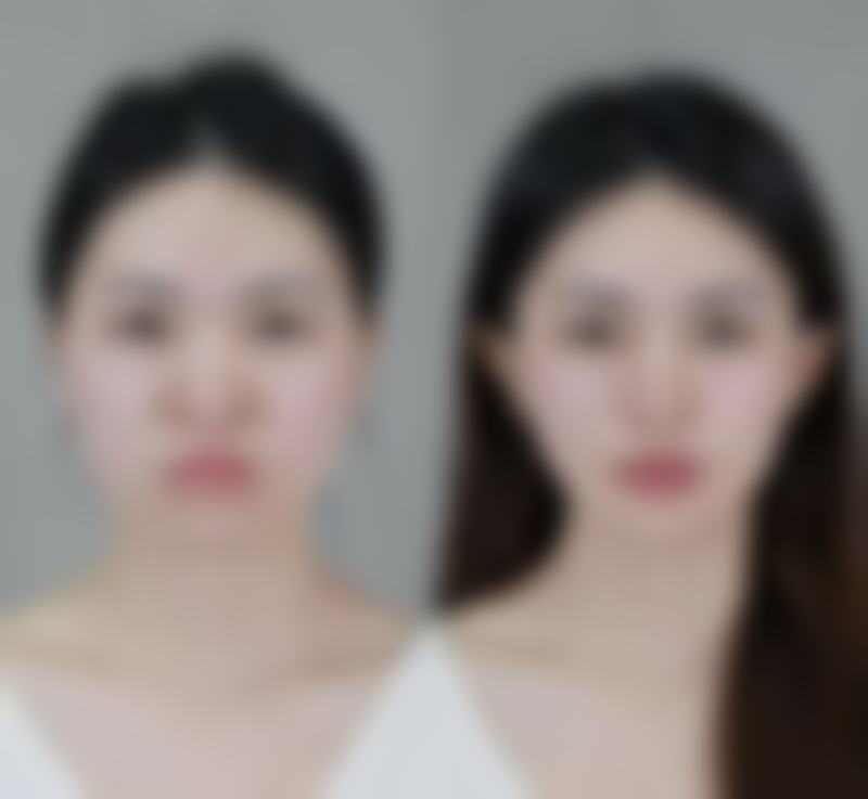 超声炮对眼袋有效果吗？了解适用情况与更优方案，视频为你揭秘！ 