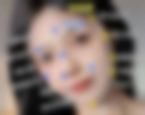 线雕隆鼻可以维持多久呢？受多因素影响一般在6 - 18个月详解来了