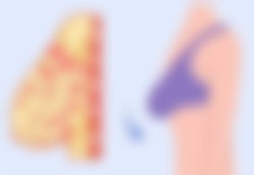 四、许昌正美韶华医疗整形真实实例