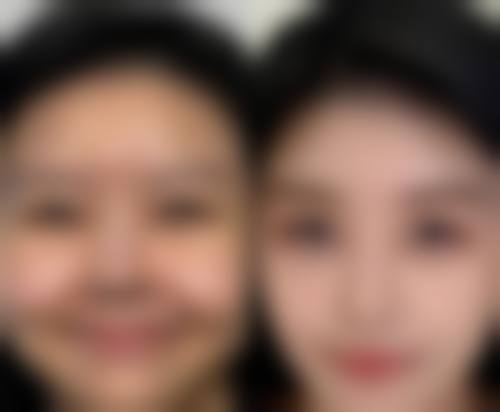 三、许昌正美韶华医疗整形热门项目