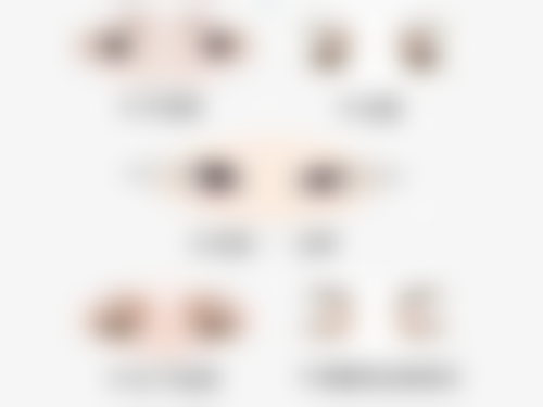 五、线提升隆鼻的风险