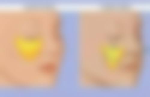 二、常见治疗方案