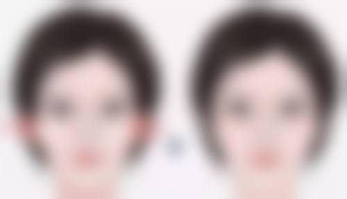 三、如何延长线提升隆鼻的成效