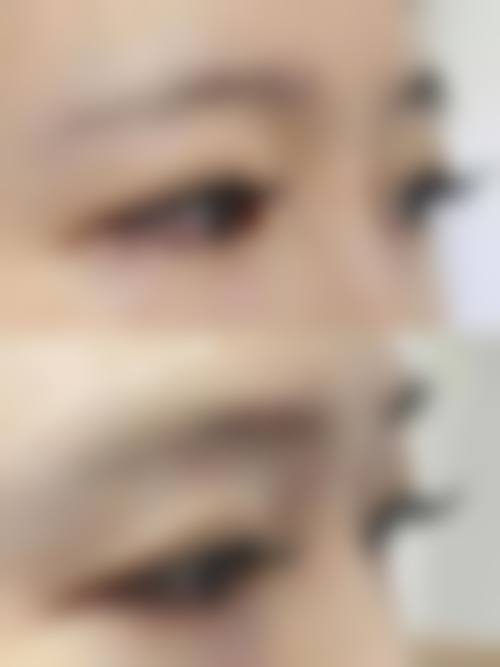 八、北京田永成医疗美容诊所真实的患者评价