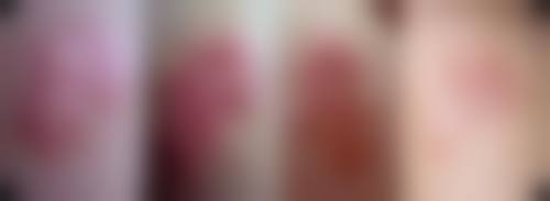 三、桐城德尔美客医疗美容门诊部诊疗项目有哪些？