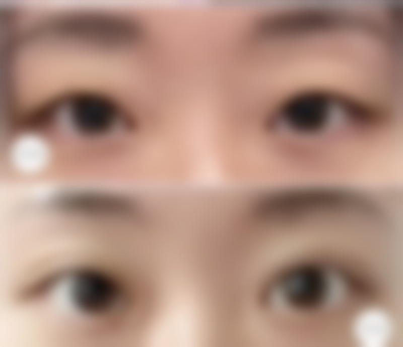 九、湘南美容 水户院真实的患者评价