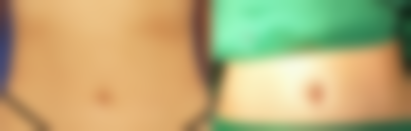 二、隆鼻二十天化妆的原则