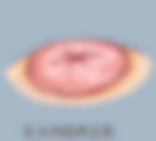 下颚不对称应该怎样矫正