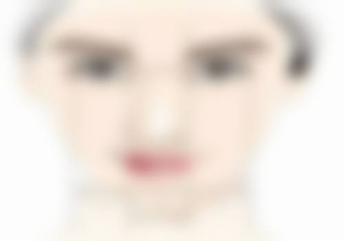 二、不同阶段护理要点及敷用时间