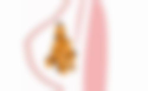 一、线提升隆鼻歪了的原因判断