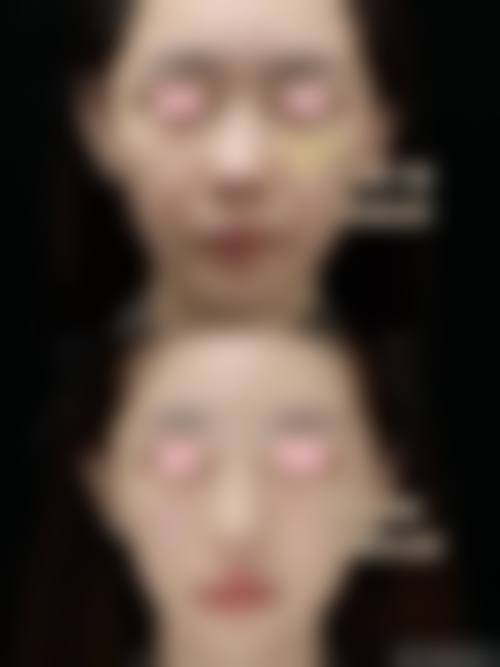 四、贵州利美康外科整形医院特色项目