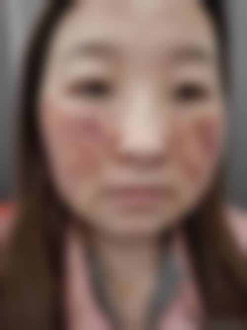 八、玉林贞韩植发医疗美容诊所预约方式