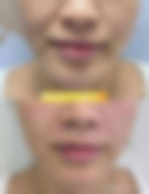 八、贵州利美康外科整形医院预约方式