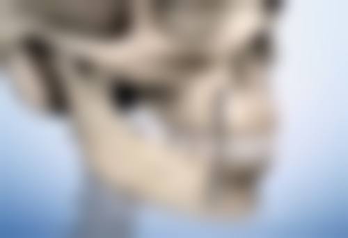 一、疤痕体质的判断