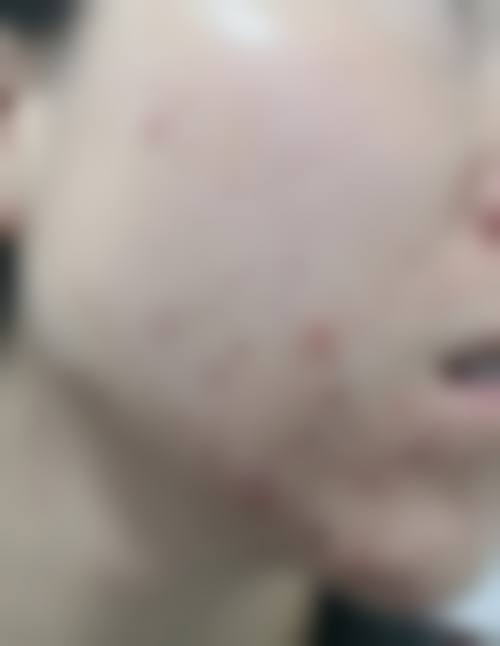 四、李光农收费价格表