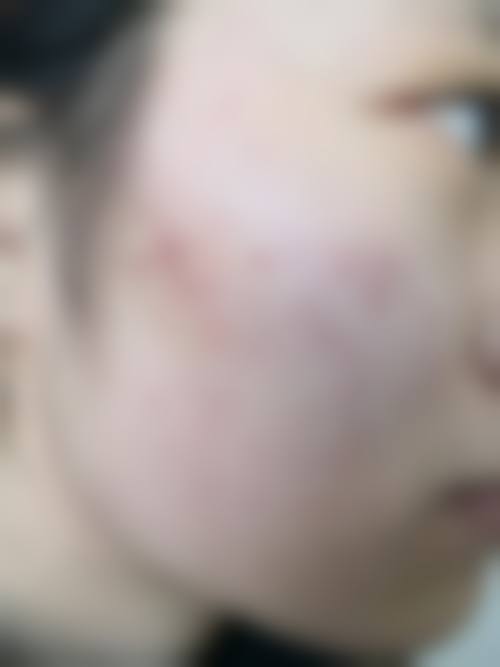 六、李光农真实的患者评价