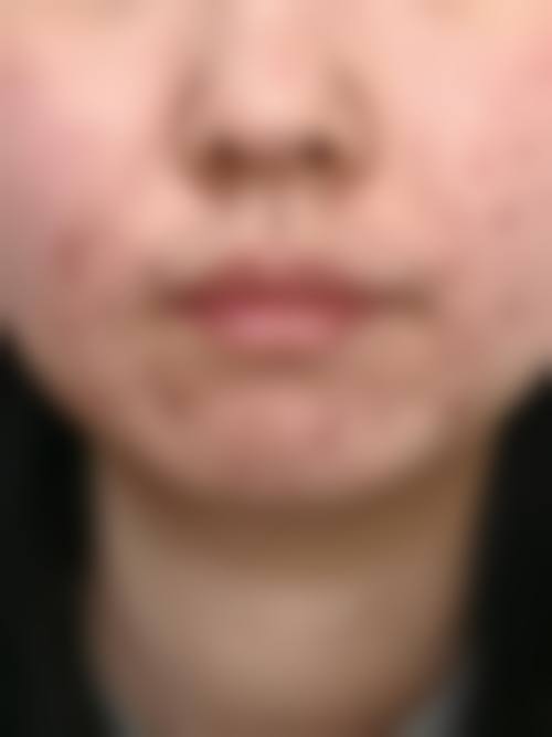 三、李光农技术优势