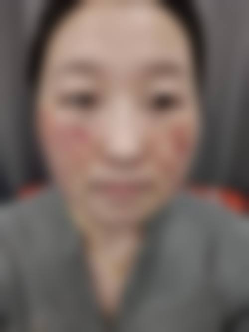 九、周口人康皮肤病综合医院医疗美容整形科真实的患者评价