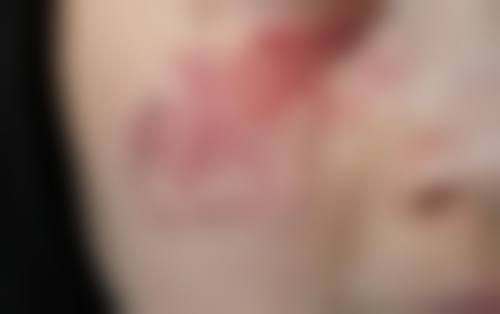 六、周口人康皮肤病综合医院医疗美容整形科价格表