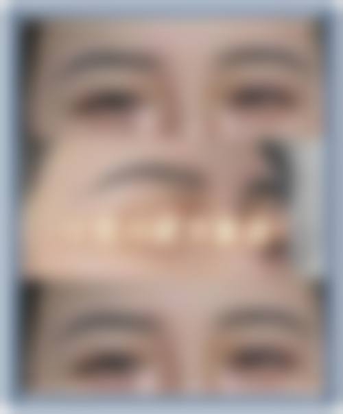 八、宁波鄞州澳玛星光整形医院真实的患者评价