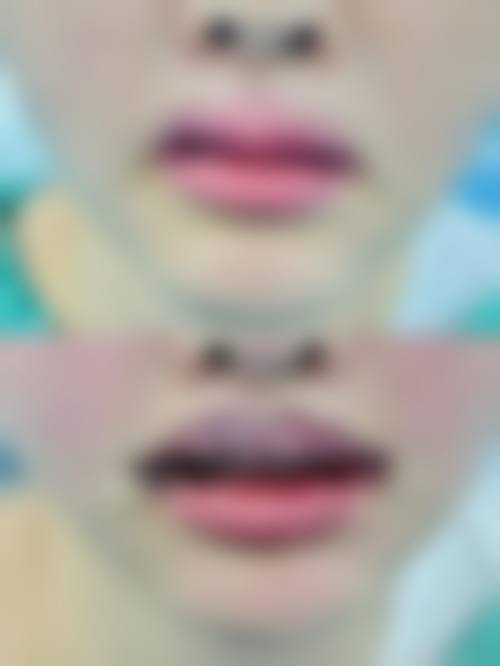 七、宁波鄞州澳玛星光整形医院预约方式