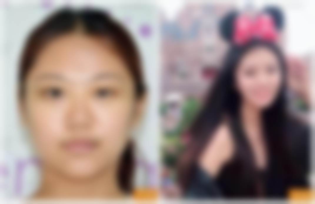 {朝阳区比较有名的医美医院大揭秘，禾美嘉、叶子等多院特色项目任你选 