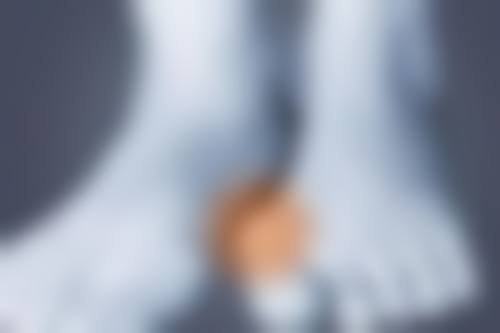 二、脸上的疤痕疙瘩治疗基础原则