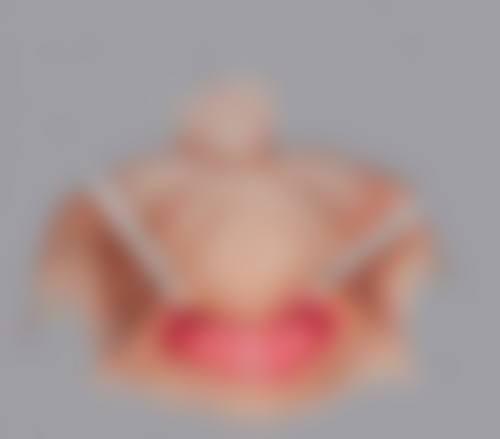 一、割了双眼皮什么时候可以洗脸