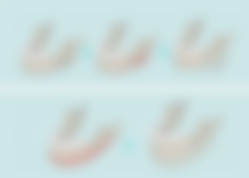 圆脸割双眼皮好看吗？个性化设计+适配形态，附图片揭秘变美密码 