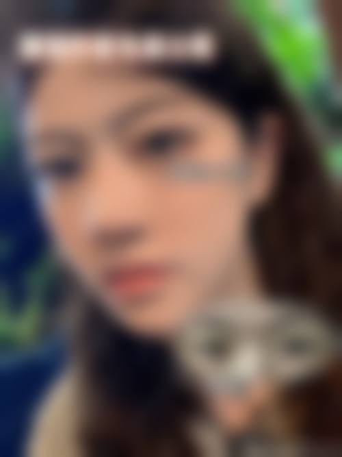 八、遂宁市中 心医院（医疗美容科）真实的患者评价