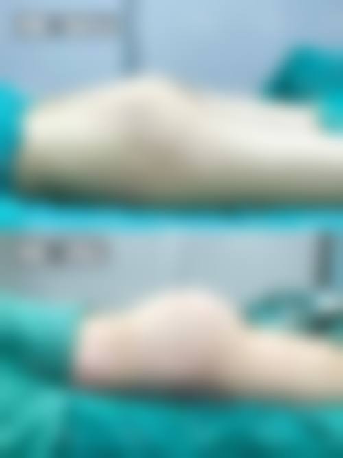 五、钟铄怎么预约？