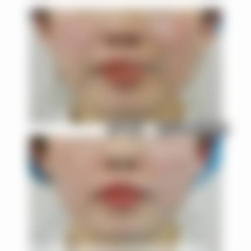 三、遂宁市中 心医院（医疗美容科）诊疗项目有哪些？