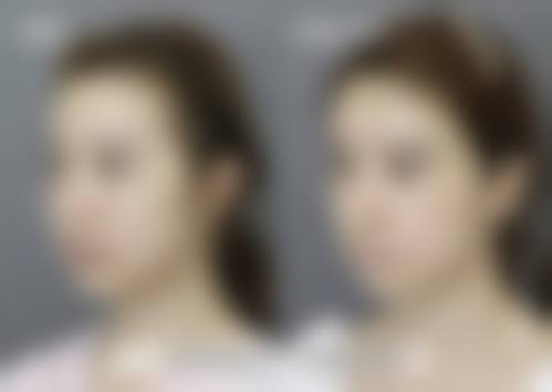 六、钟铄真实的患者评价