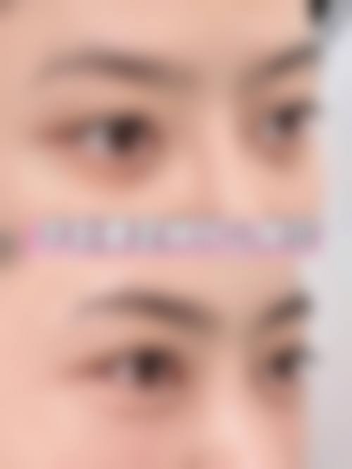 九、东营创颜美整形医院真实的患者评价