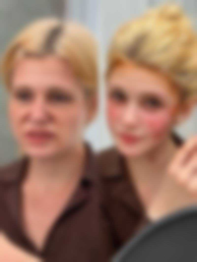 六、打完瘦脸针的成效及时间