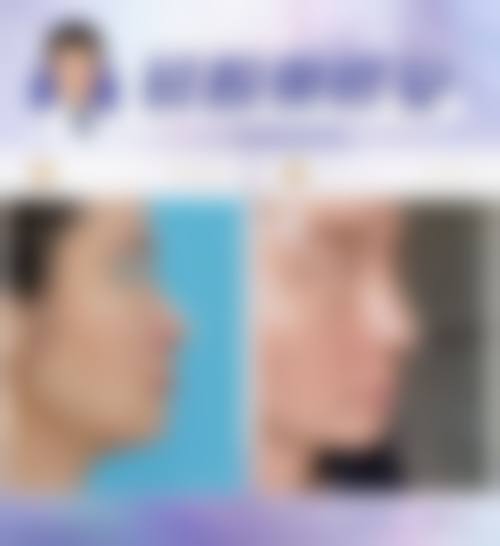 五、方锦平怎么预约？