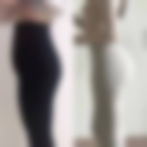 二、新疆乌鲁木齐千禧丽人整形美容医院怎么样？