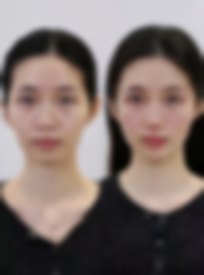 四、新疆乌鲁木齐千禧丽人整形美容医院特色项目