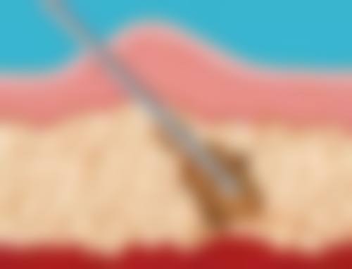 六、赤峰康华皮肤医院地址及交通