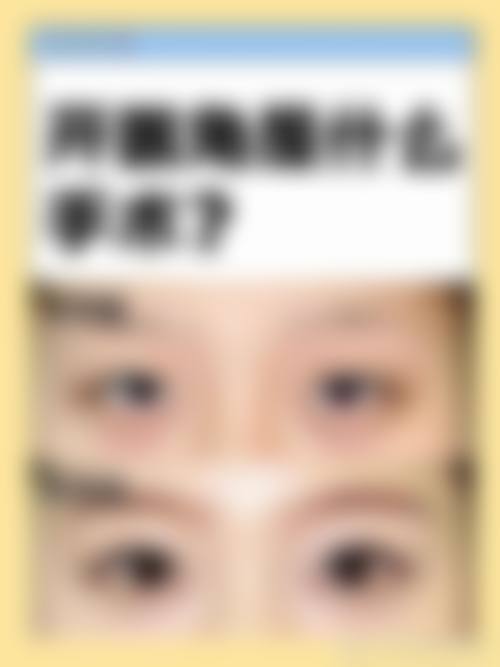 四、西安先雁塔柏凯医疗美容医院特色项目