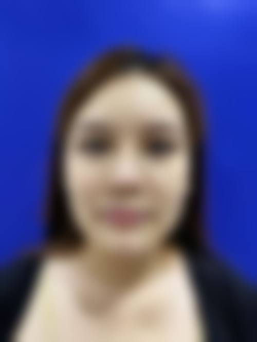 四、南昌美诺医疗美容门诊部特色项目