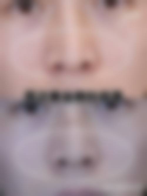 五、菏泽丽雅医疗美容门诊部价格表